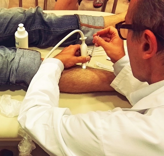 Zdravljenje žariščne spastičnosti – modul zgornji ud